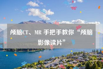 颅脑CT、MR 手把手教你“颅脑影像读片”